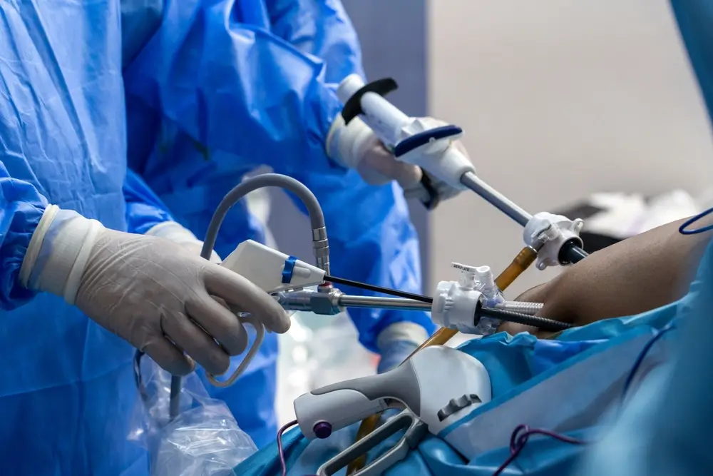 Laparoscopic Gallbladder Removal: What to Expect at BASC